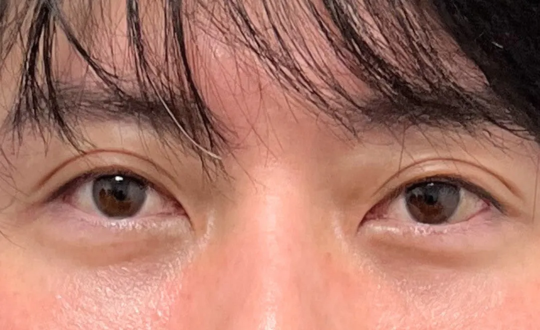 Case 1 After