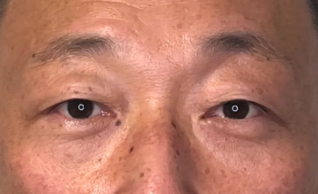Case 2 After