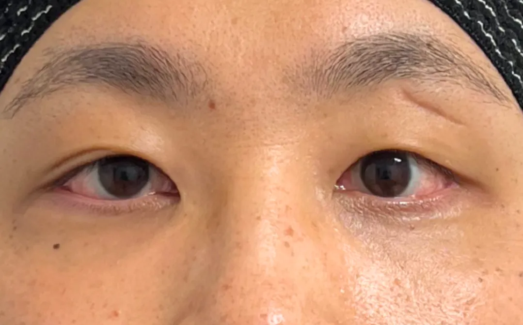 Case 4 After