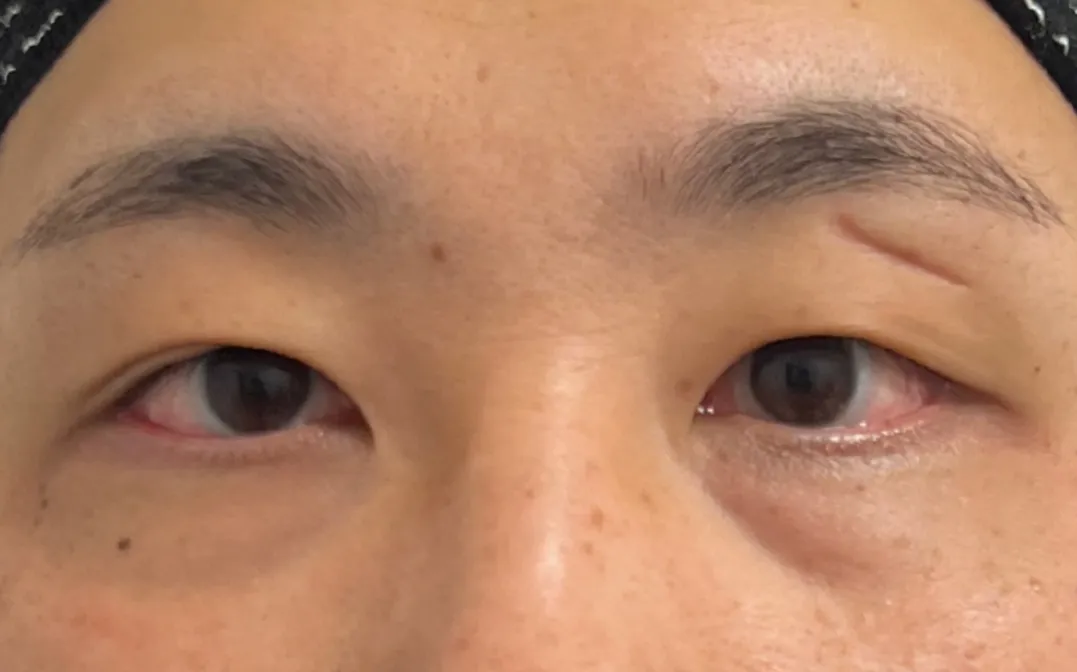 Case 4 Before